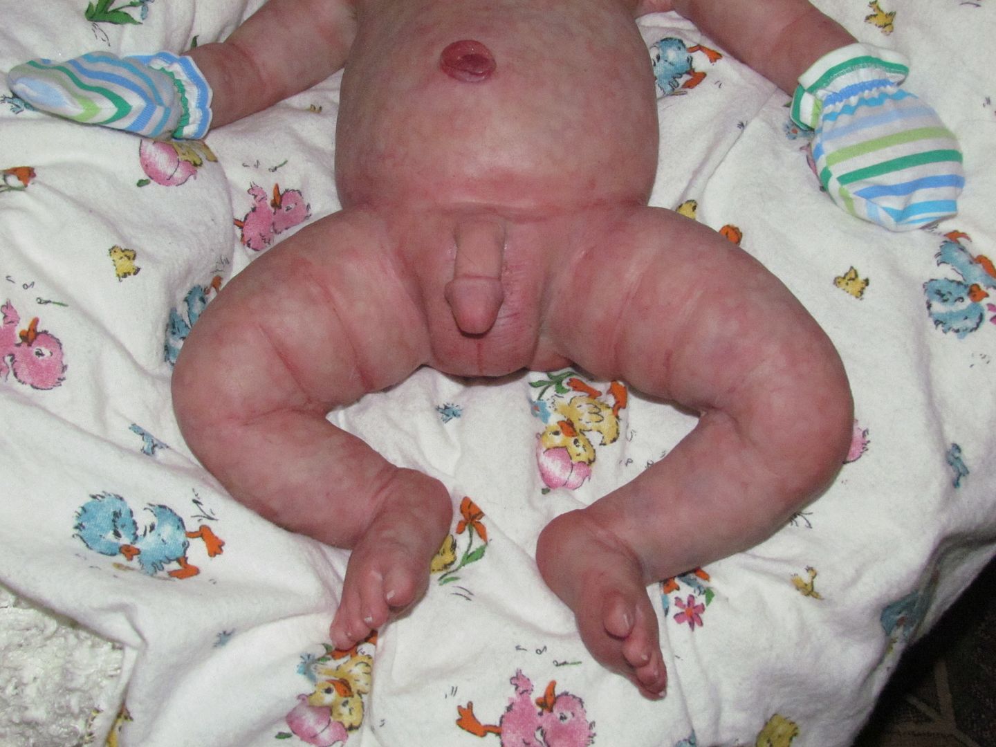 newborn diaper rash #10