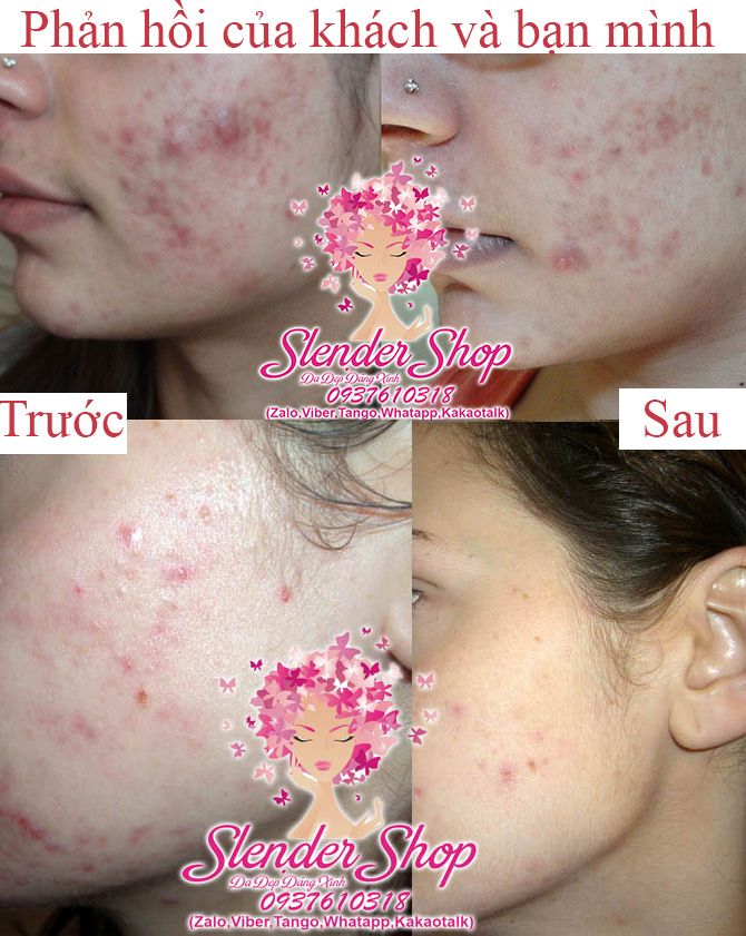 Slender shop - Sỉ lẻ sản phẩm làm đẹp  của Nhật Bản ( Hình thật 100% ) mình đang xài - 10